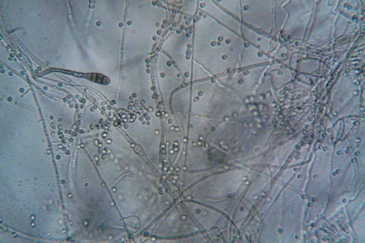 Fungal ‘Brains’ Can Think Like Human Minds, Scientists Say