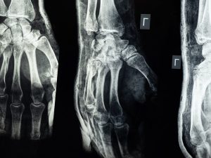 Doctor Speaks Out on Three Bizarre Theories About People Who Have