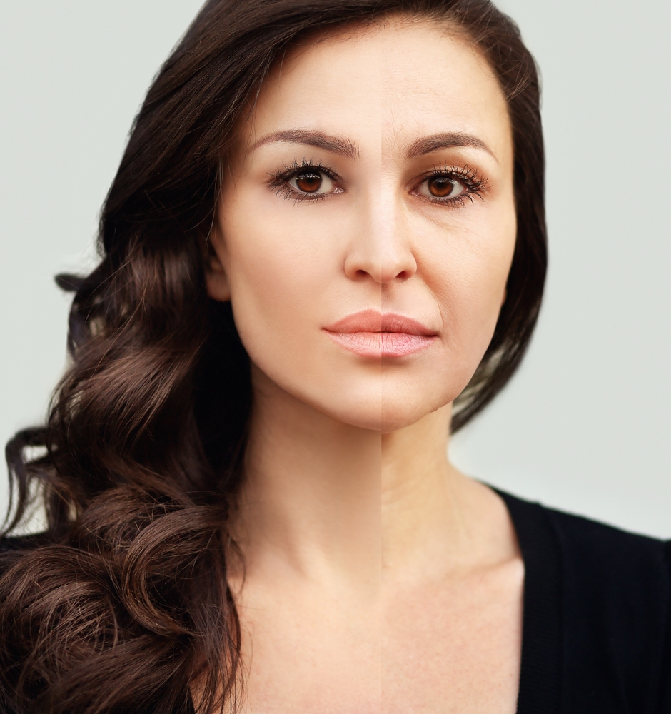 Doctor Injects Just One Half of Her Face with Botox to Reveal What It Really Does to Your Face