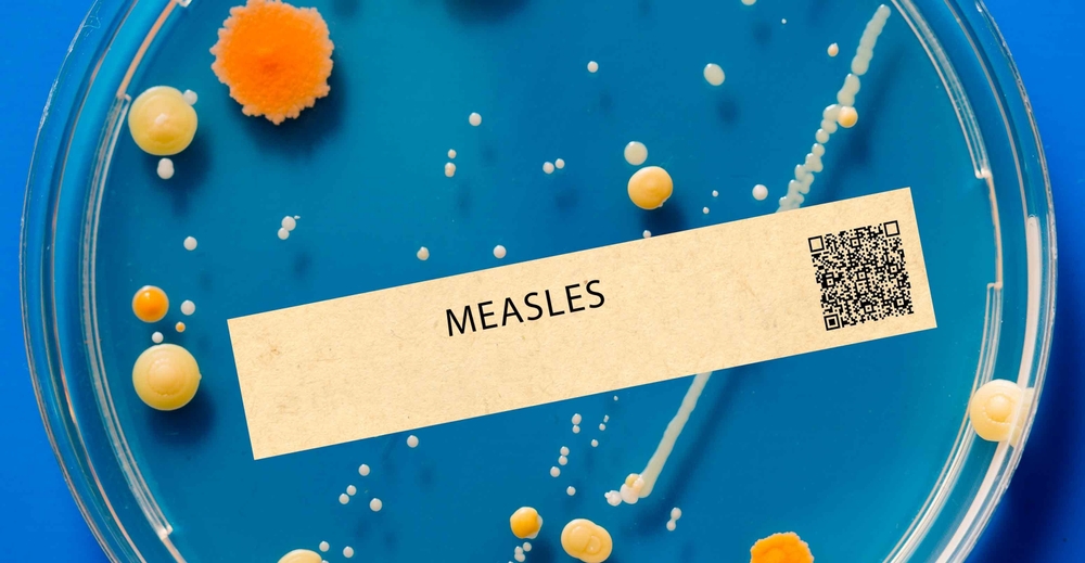 South Carolina Confirms Major Measles Outbreak, Health Officials Issue Safety Warning