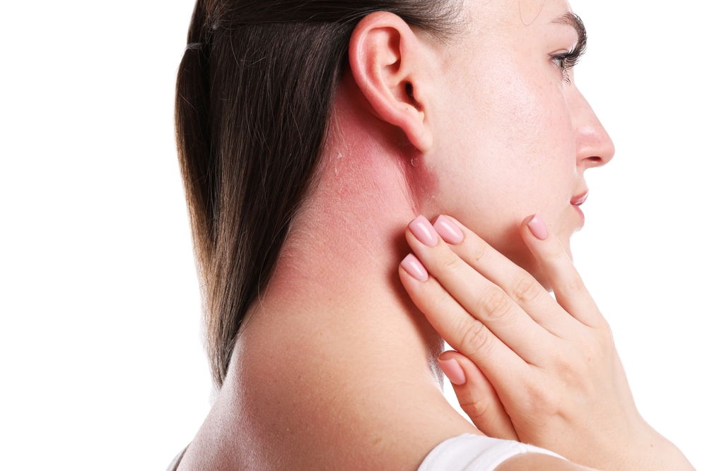 These people say their skin began “falling off” after years of eczema treatment