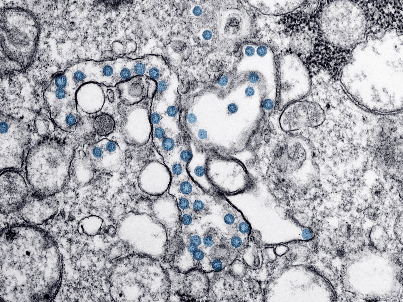 Mystery Parasite Outbreak Spreads Across the US as the CDC Hunts for a Source