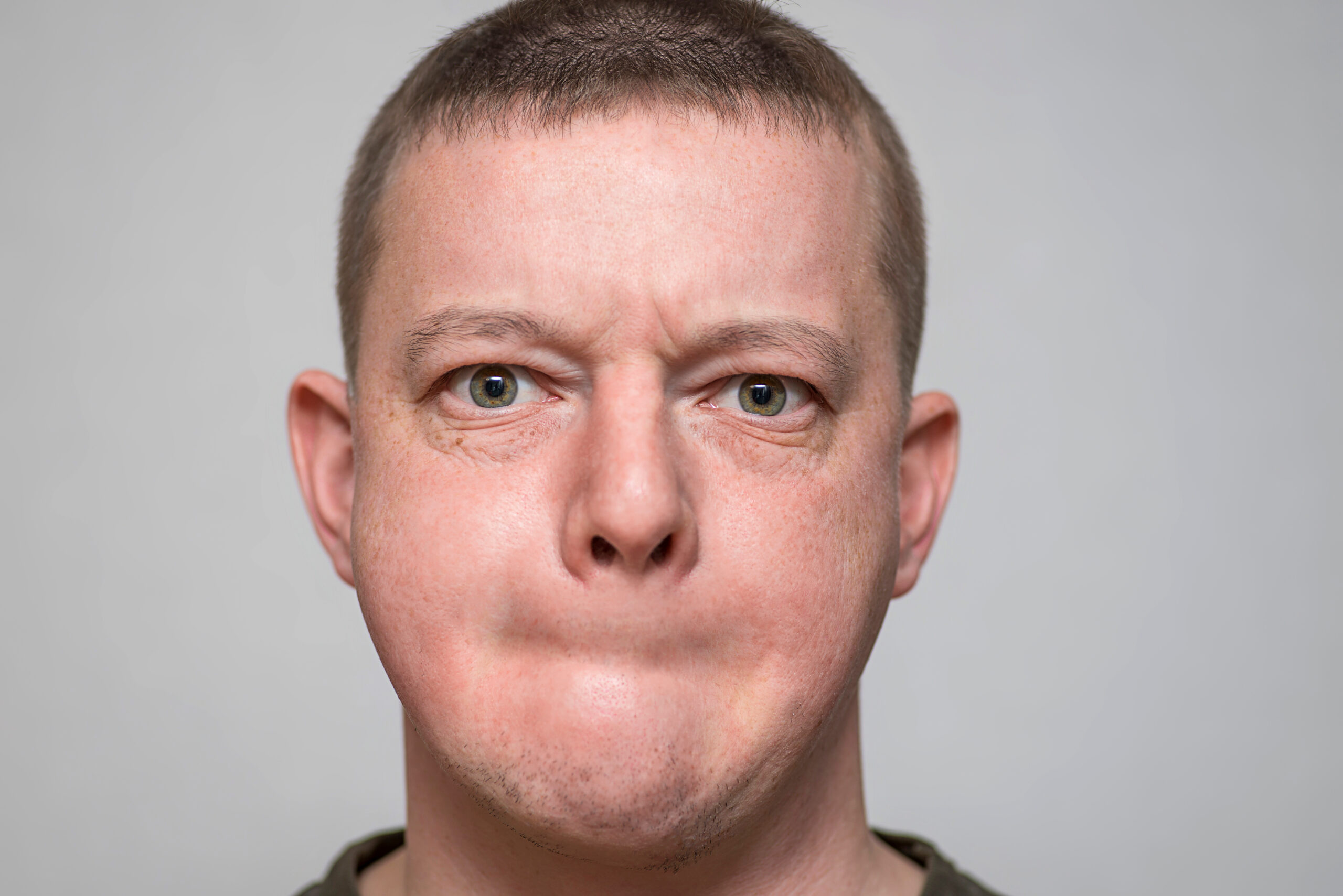 Man Loses Part Of His Jaw Chasing Phone Thief Before Surgeons Rebuild It Using His Leg