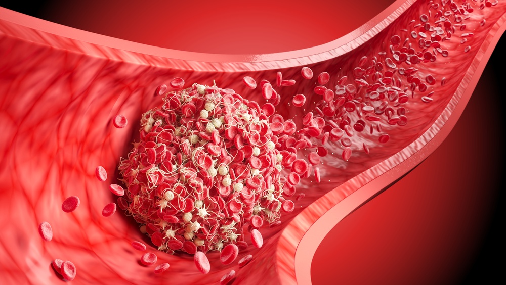 Scientists Discover Unexpected Change Happening Inside Human Blood as CO₂ Levels Rise