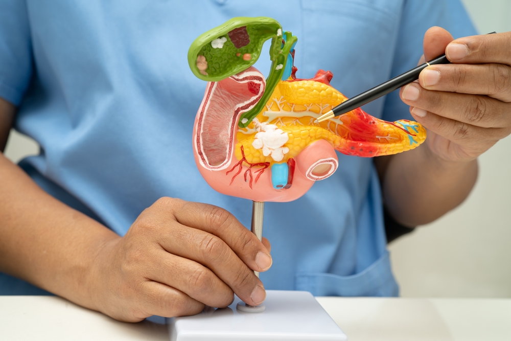 FDA Approves New Pancreatic Cancer Drug After Trial Nearly Doubled Median Survival