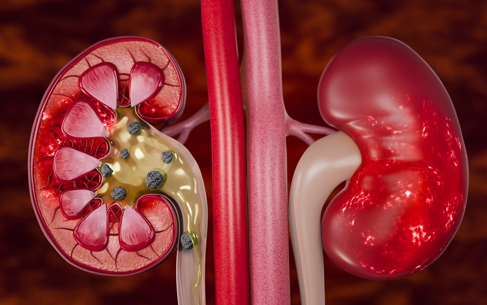 Scientists May Have Found A Way To Make More Kidneys Compatible With Patients