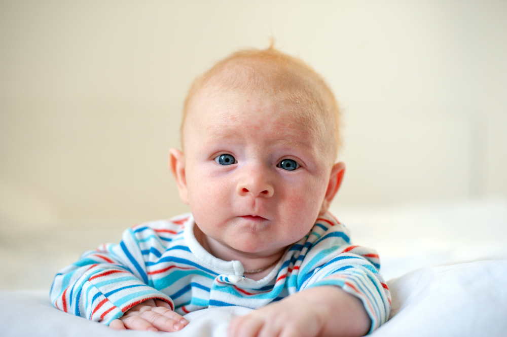 Baby Born Without A Nose Became Famous For His Infectious Smile