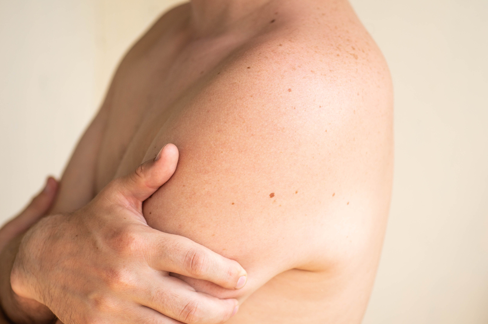 A Wife Drew Circles Around Her Husband’s Moles Before His Doctor Visit. He Came Home With Notes on His Skin